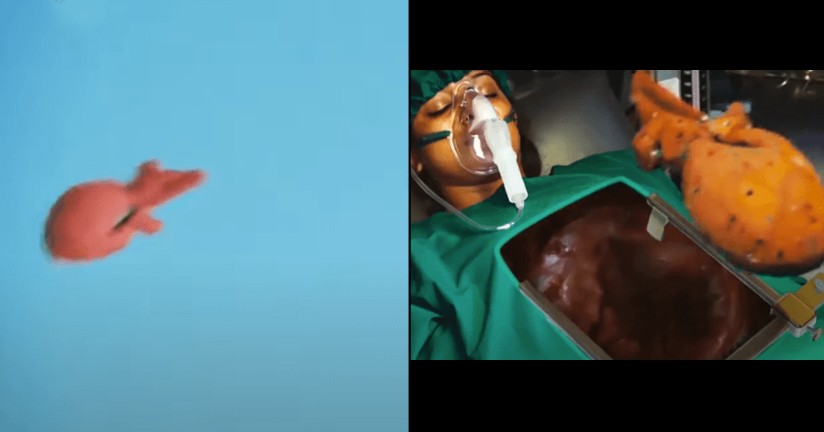 Hilarious ‘Heart-Transplant’ Scene From A South Film Has Netizens Questioning The Laws Of Science