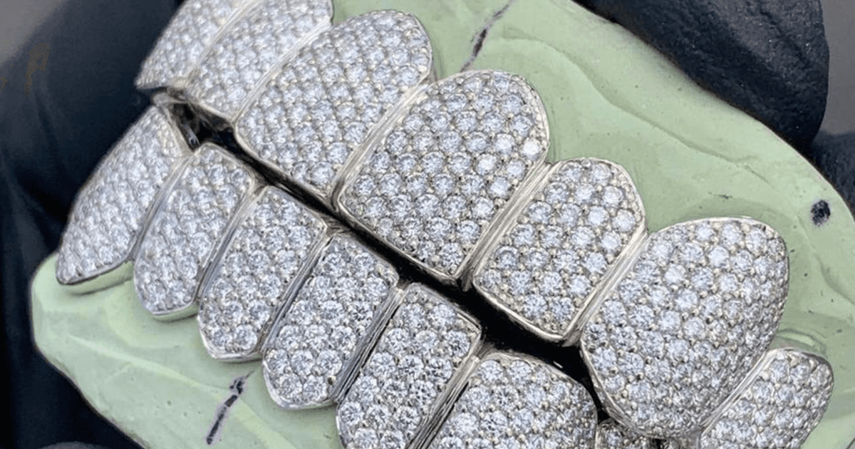 Surat Jewellers Are Selling Diamond Dentures For ₹40 Lakh So You Can Bite Like The Royals Do